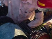 Мужчина в Первомайске пострадал при работе с электрической пилой